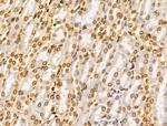 E2F4 Antibody in Immunohistochemistry (Paraffin) (IHC (P))