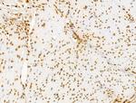 E2F4 Antibody in Immunohistochemistry (Paraffin) (IHC (P))