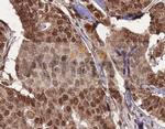 HDAC10 Antibody in Immunohistochemistry (Paraffin) (IHC (P))