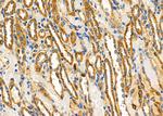 HSPE1 Antibody in Immunohistochemistry (Paraffin) (IHC (P))