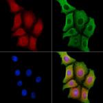 Mammaglobin B Antibody in Immunocytochemistry (ICC/IF)