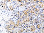 Mammaglobin B Antibody in Immunohistochemistry (Paraffin) (IHC (P))