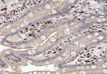 Mammaglobin B Antibody in Immunohistochemistry (Paraffin) (IHC (P))