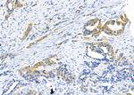 MMP11 Antibody in Immunohistochemistry (Paraffin) (IHC (P))