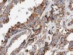 gamma Synuclein Antibody in Immunohistochemistry (Paraffin) (IHC (P))