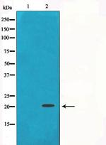 gamma Synuclein Antibody in Western Blot (WB)