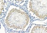 TRIM38 Antibody in Immunohistochemistry (Paraffin) (IHC (P))