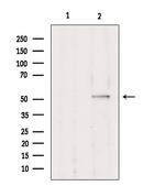 TRIM38 Antibody in Western Blot (WB)