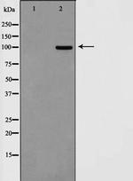 SAPAP1 Antibody in Western Blot (WB)