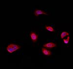 TRIM24 Antibody in Immunocytochemistry (ICC/IF)