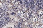 TRIM24 Antibody in Immunohistochemistry (Paraffin) (IHC (P))