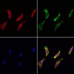 MOS Antibody in Immunocytochemistry (ICC/IF)