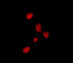 TFE3 Antibody in Immunocytochemistry (ICC/IF)