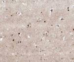 TFE3 Antibody in Immunohistochemistry (Paraffin) (IHC (P))