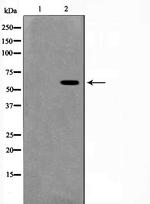 MUTYH Antibody in Western Blot (WB)