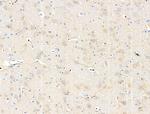 ABCF1 Antibody in Immunohistochemistry (Paraffin) (IHC (P))