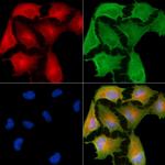 C1orf35 Antibody in Immunocytochemistry (ICC/IF)