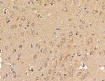 C1orf35 Antibody in Immunohistochemistry (Paraffin) (IHC (P))