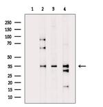 C1orf35 Antibody in Western Blot (WB)