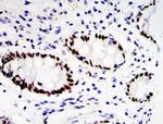 ETV4 Antibody in Immunohistochemistry (Paraffin) (IHC (P))