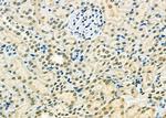 ETV4 Antibody in Immunohistochemistry (Paraffin) (IHC (P))