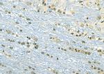 ETV4 Antibody in Immunohistochemistry (Paraffin) (IHC (P))