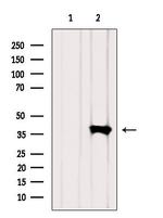 GAS41 Antibody in Western Blot (WB)