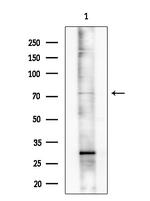 hnRNP M1-M4 Antibody in Western Blot (WB)