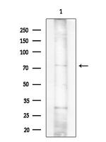 hnRNP M1-M4 Antibody in Western Blot (WB)