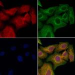 AGPAT9 Antibody in Immunocytochemistry (ICC/IF)