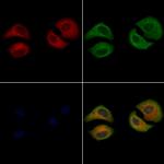 LRAT Antibody in Immunocytochemistry (ICC/IF)