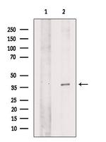 LRAT Antibody in Western Blot (WB)