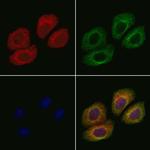 NT5C3A Antibody in Immunocytochemistry (ICC/IF)