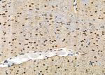 MAST3 Antibody in Immunohistochemistry (Paraffin) (IHC (P))