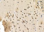 MAST3 Antibody in Immunohistochemistry (Paraffin) (IHC (P))