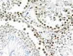 VPS72 Antibody in Immunohistochemistry (Paraffin) (IHC (P))