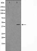 VPS72 Antibody in Western Blot (WB)