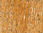 FKRP Antibody in Immunohistochemistry (Paraffin) (IHC (P))