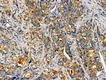 AKAP3 Antibody in Immunohistochemistry (Paraffin) (IHC (P))