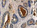 AKAP3 Antibody in Immunohistochemistry (Paraffin) (IHC (P))