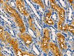 AKAP3 Antibody in Immunohistochemistry (Paraffin) (IHC (P))