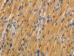 AKAP3 Antibody in Immunohistochemistry (Paraffin) (IHC (P))