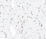 PIAS1 Antibody in Immunohistochemistry (Paraffin) (IHC (P))