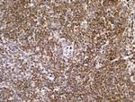 PIAS1 Antibody in Immunohistochemistry (Paraffin) (IHC (P))