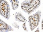 PIAS1 Antibody in Immunohistochemistry (Paraffin) (IHC (P))