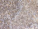 PIAS1 Antibody in Immunohistochemistry (Paraffin) (IHC (P))