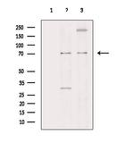 PIAS1 Antibody in Western Blot (WB)