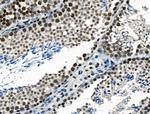 TRIP13 Antibody in Immunohistochemistry (Paraffin) (IHC (P))