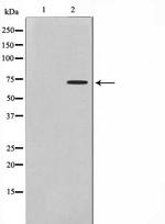 DMPK Antibody in Western Blot (WB)