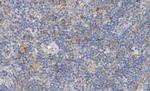 EGR1 Antibody in Immunohistochemistry (Paraffin) (IHC (P))